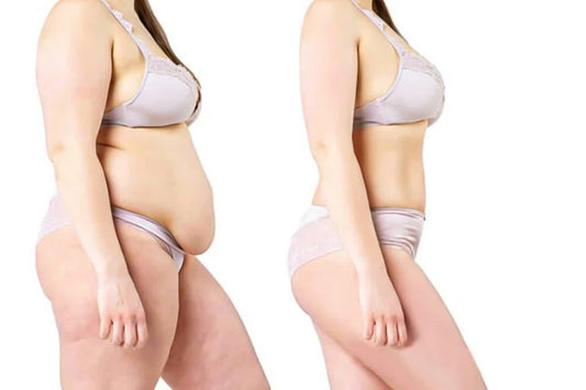 How to Use a Vacuum Slim Machine at Home?