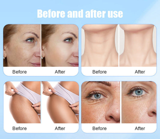 anti-aging beauty treatments