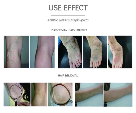 Remove Spots & Brighten Skin