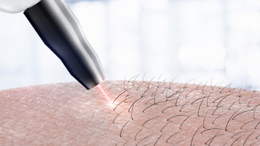 Pros of the  Super Laser Hair Removal Treatment