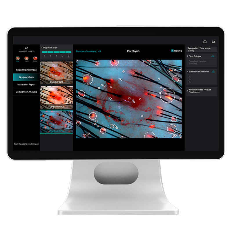 FARSLIM Portable AI 3D skin analyzer Hair and Scalp Analyzer Scanner