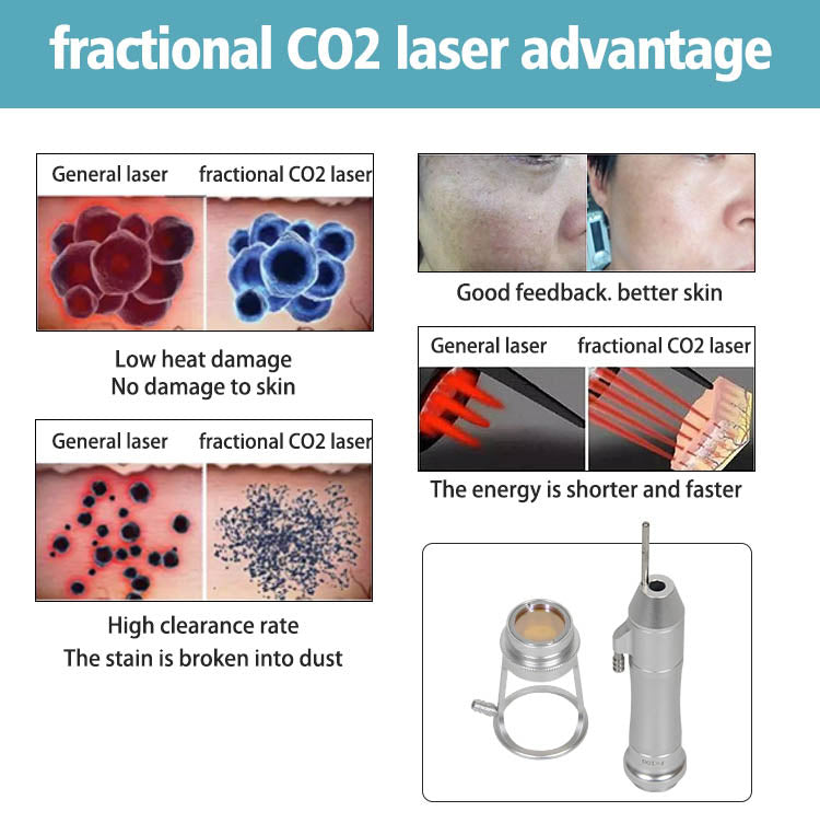 Farslim| professional Fractional CO2 Laser machine|RF Metal Tube Medical Laser CO2 Fractional | Fractional CO2 Laser Vaginal Tightening Machine