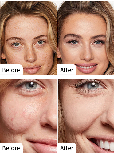Brighter complexion