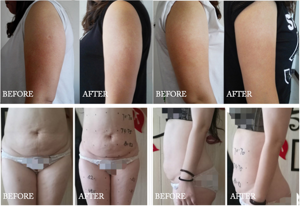 Firmer, lifted skin