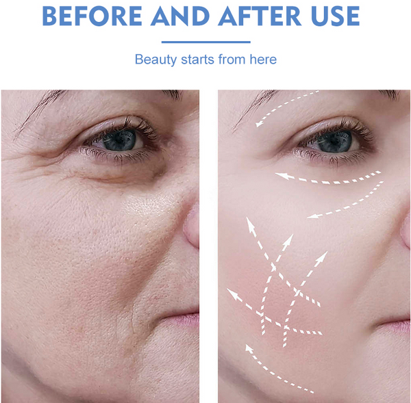 Reduced fine lines