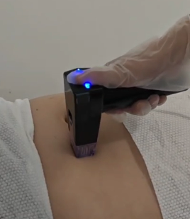 Crystallite Depth 8 Gold RF Microneedling Machine | FARSLIM B27